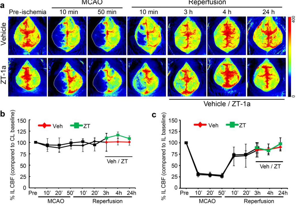 Monitoraggio Del Flusso Sanguigno Cerebrale Perimed